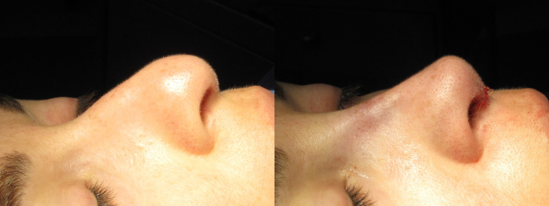 Patient 60 Combined Image