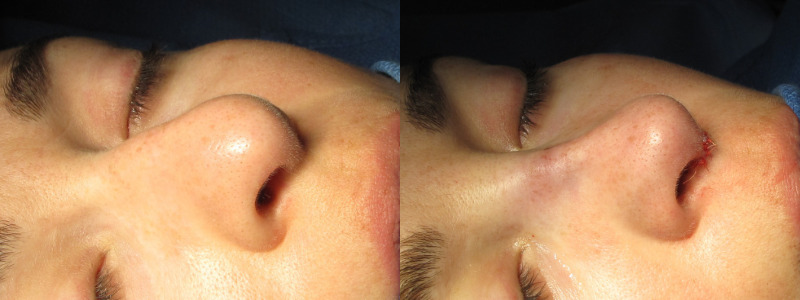 Patient 60 Combined Image