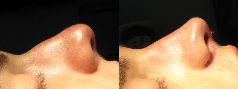 Patient 56 Combined Image