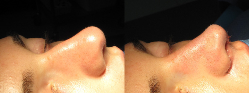 Patient 56 Combined Image