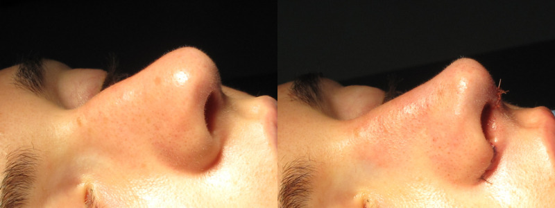 Patient 56 Combined Image