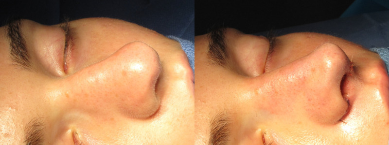 Patient 56 Combined Image