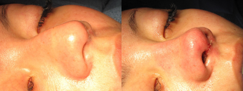 Patient 65 Combined Image