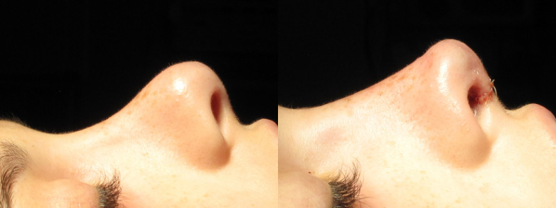 Patient 59 Combined Image