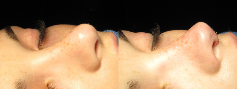 Patient 59 Combined Image