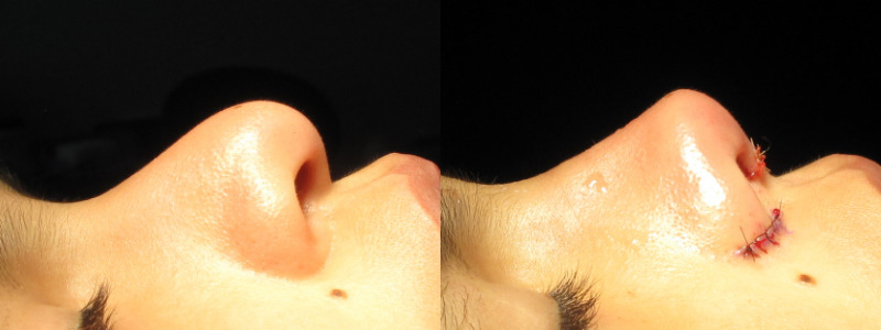 Patient 55 Combined Image