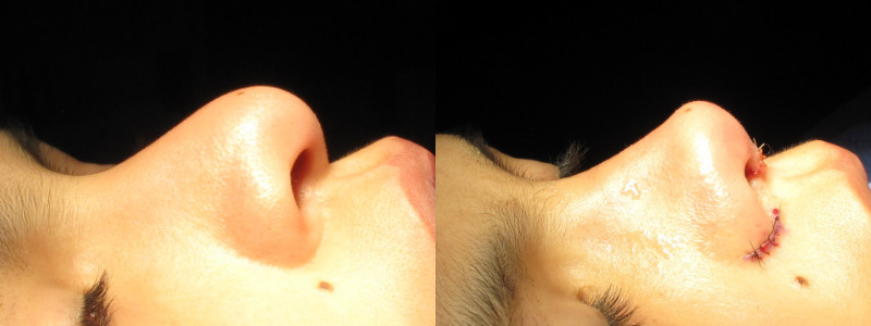 Patient 55 Combined Image