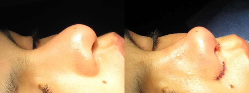 Patient 55 Combined Image