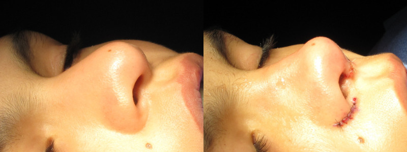 Patient 55 Combined Image