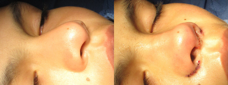 Patient 55 Combined Image