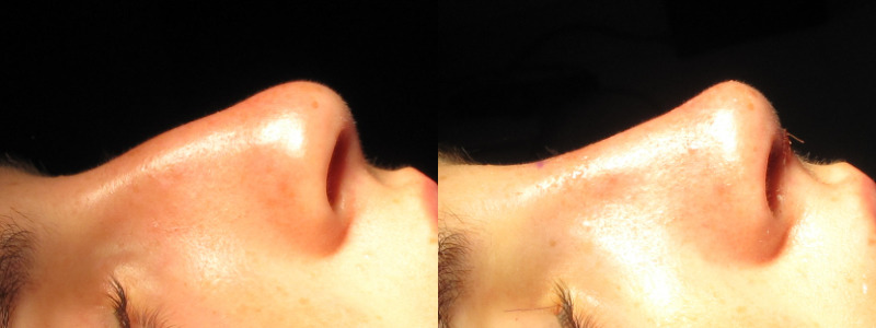 Patient 54 Combined Image