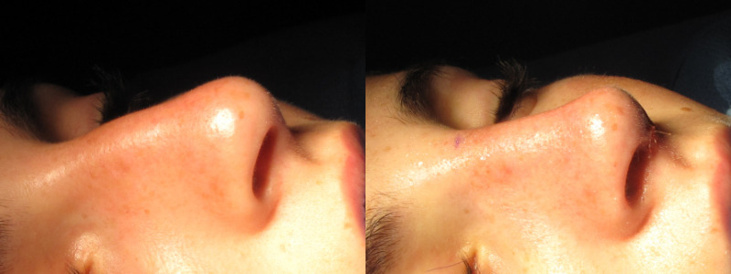 Patient 54 Combined Image