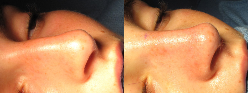 Patient 54 Combined Image