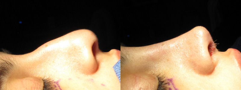 Patient 58 Combined Image