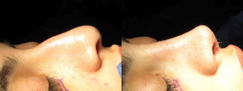 Patient 58 Combined Image