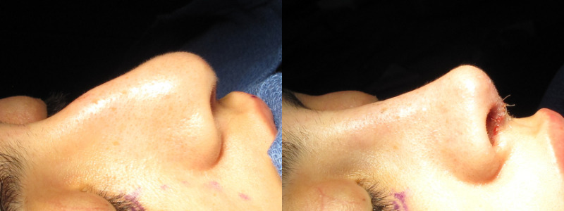 Patient 58 Combined Image