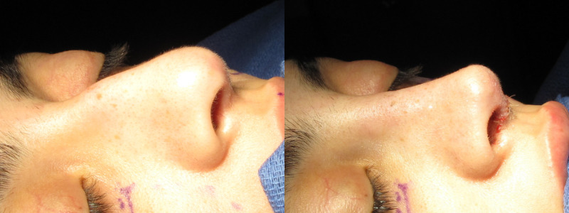 Patient 58 Combined Image