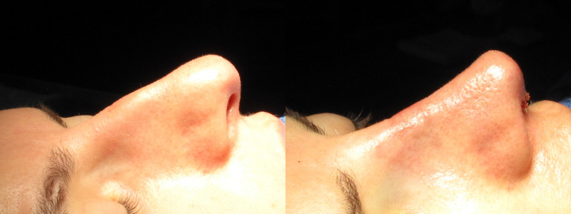 Patient 57 Combined Image