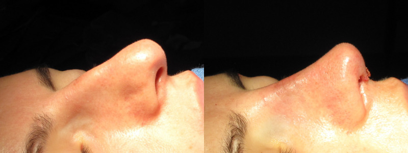 Patient 57 Combined Image