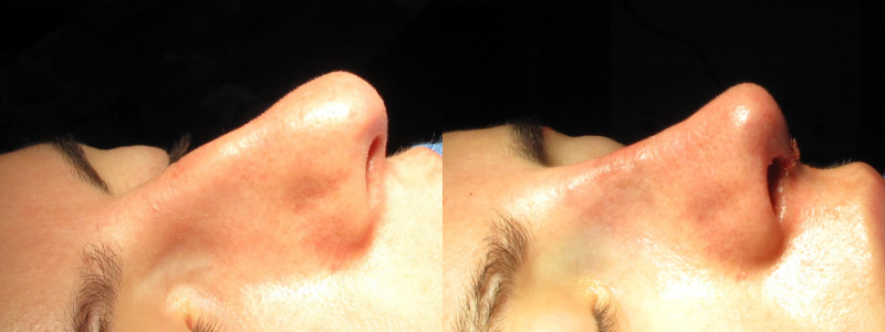 Patient 57 Combined Image