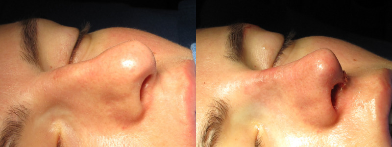 Patient 57 Combined Image