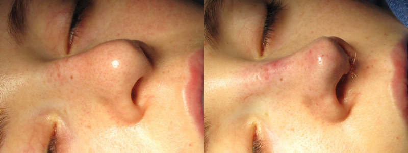 Patient 61 Combined Image