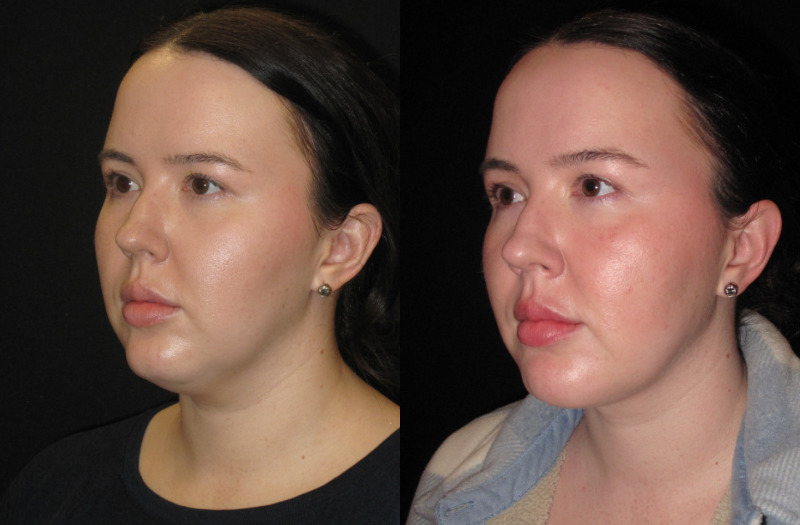 Patient 79 Combined Image