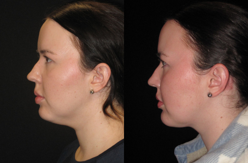 Patient 79 Combined Image