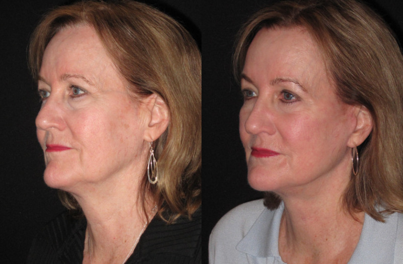 Patient 76 Combined Image