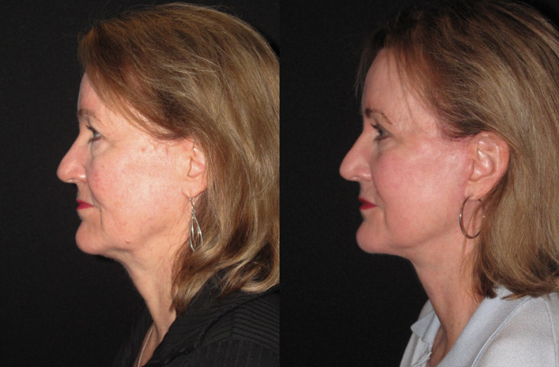 Patient 76 Combined Image