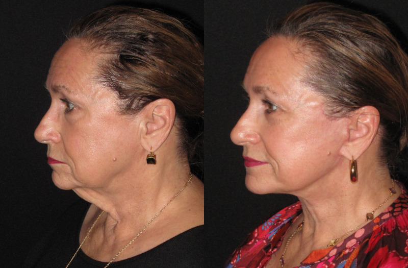 Patient 88 Combined Image