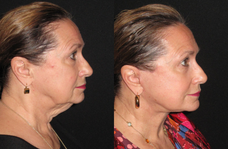 Patient 88 Combined Image