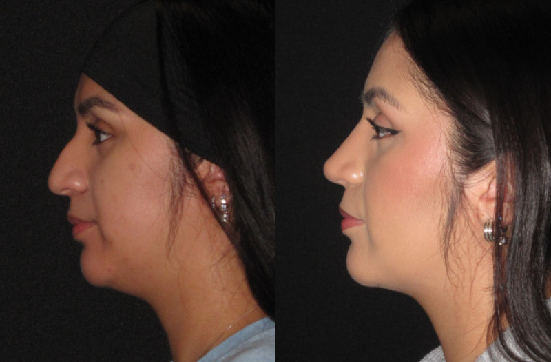 Patient 84 Combined Image