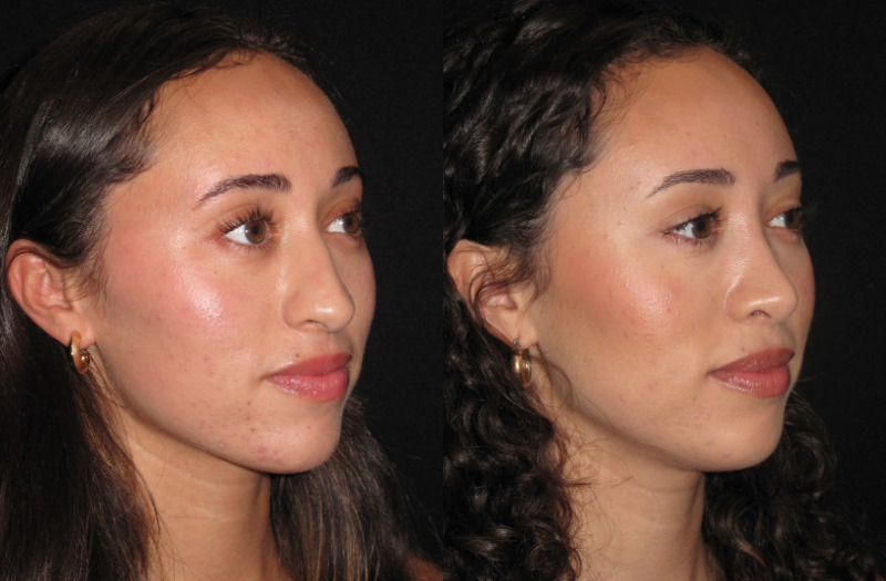 Patient 82 Combined Image