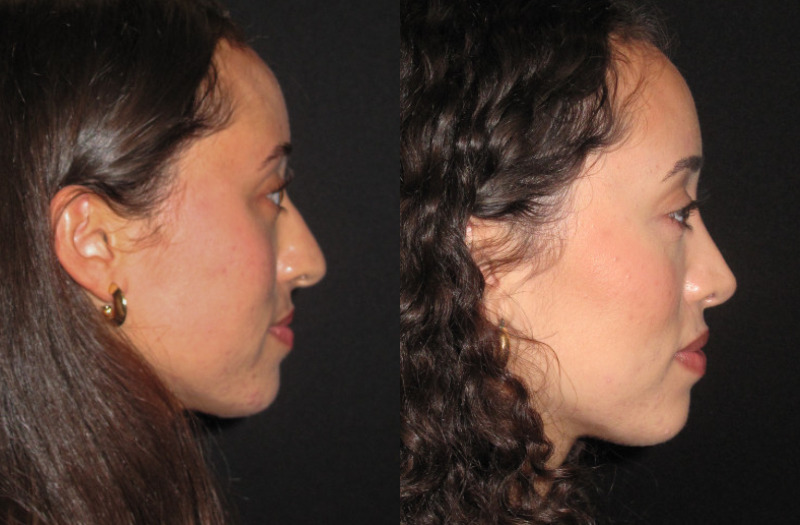 Patient 82 Combined Image