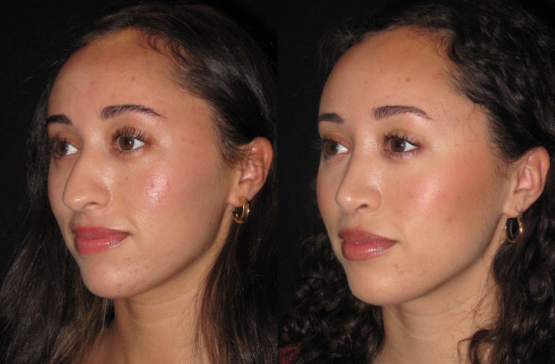 Patient 82 Combined Image