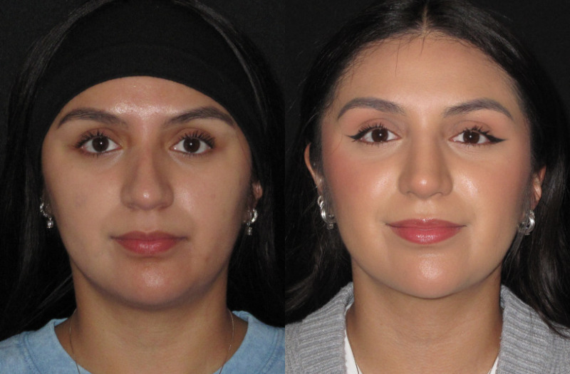 Patient 84 Combined Image