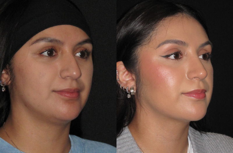 Patient 84 Combined Image