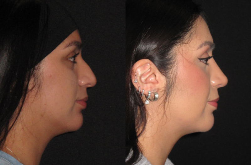 Patient 84 Combined Image