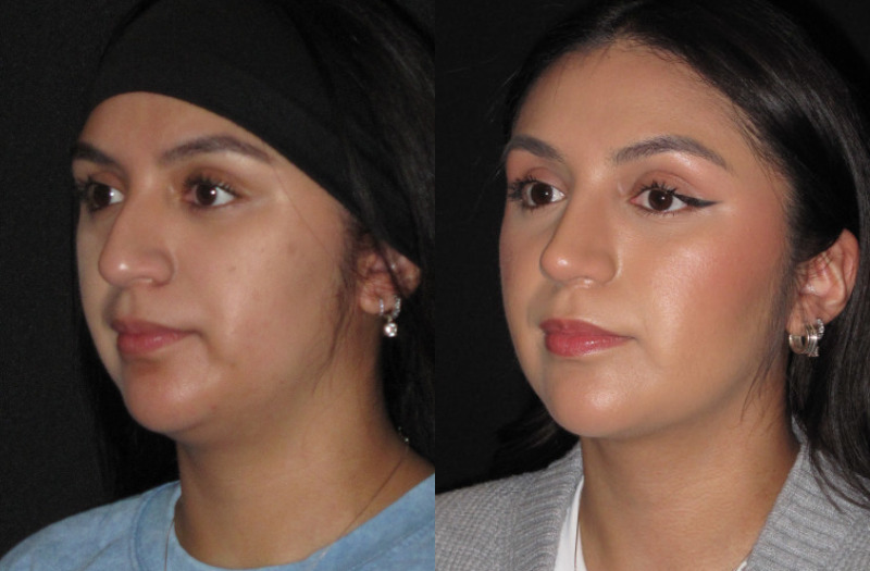 Patient 84 Combined Image