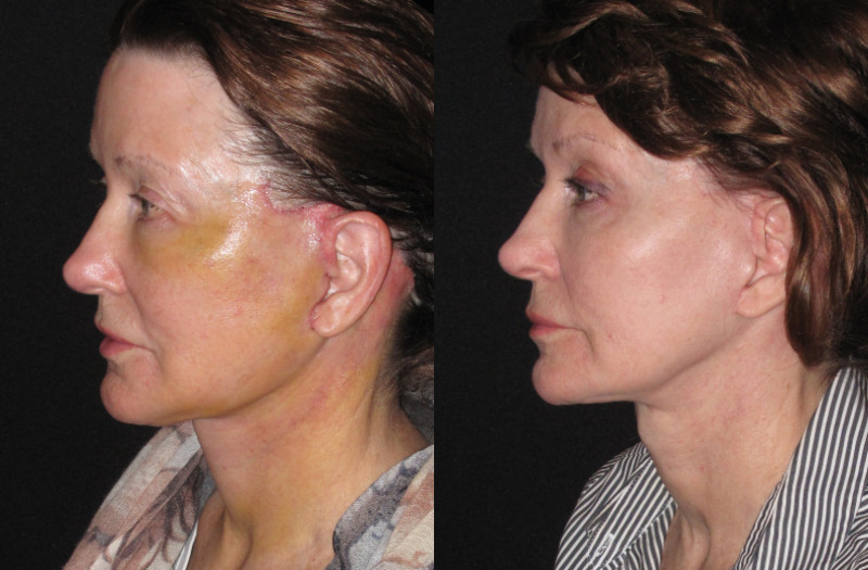 Patient 94 Combined Image