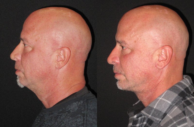 Patient 96 Combined Image