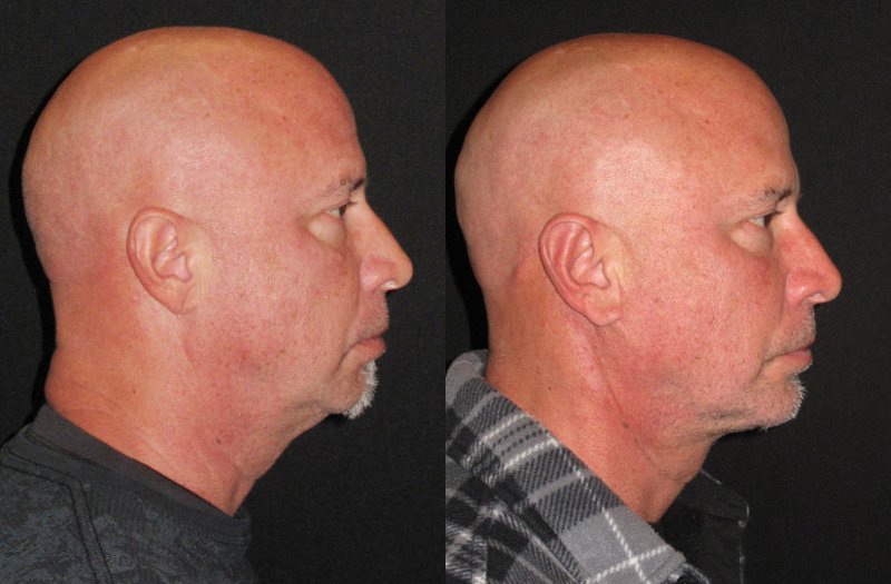 Patient 96 Combined Image